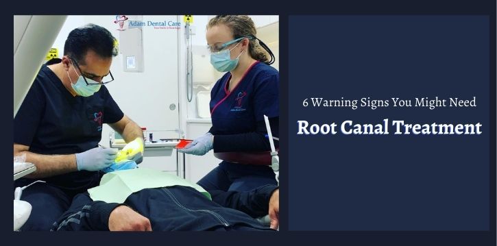 Root Canal Dentist Moorebank